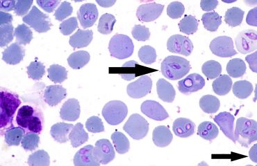 Anemia hemolitică autoimună secundară infecţiilor hemoparazitare la câine
